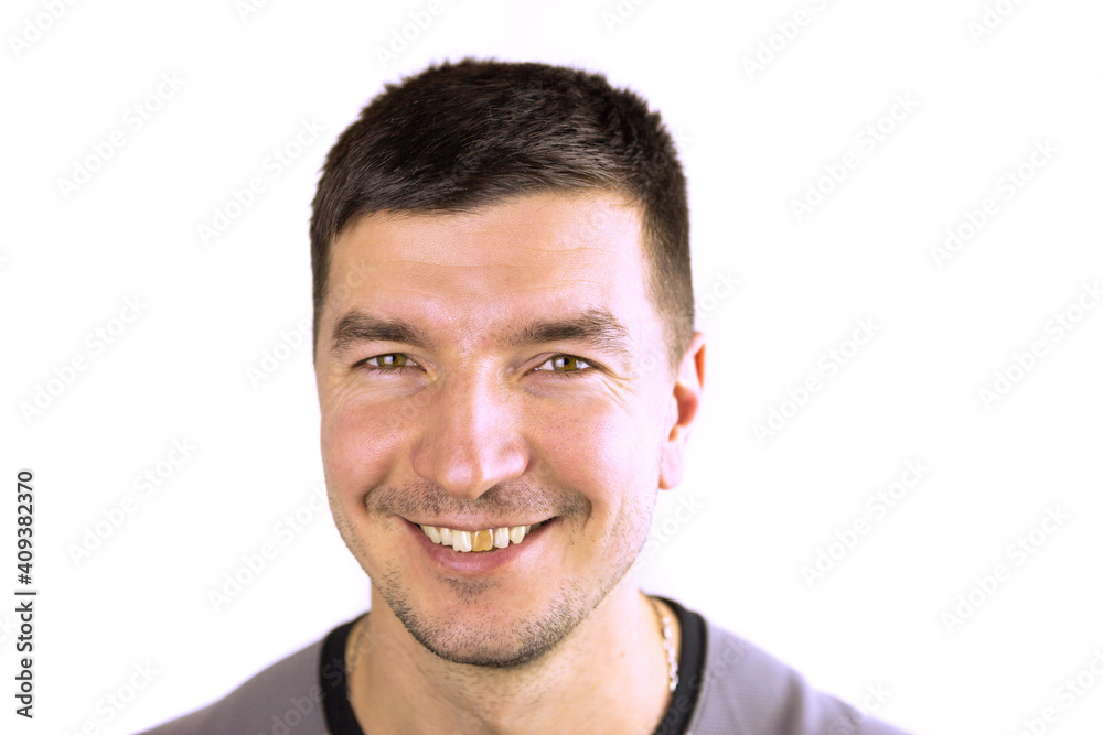 Yellow damaged tooth of a smiling Caucasian man in close-up. Focus on the teeth. Dental problems, dead teeth, enamel whitening, aesthetic restoration. Natural enamel, body positive Yellow damaged tooth of a smiling Caucasian man in close-up. Focus on the teeth. Dental problems, dead teeth, enamel whitening, aesthetic restoration. Natural enamel, body positive