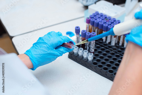 Blood test in the laboratory. Laboratory assistant working with the dispenser. Vacuum tubes with blood