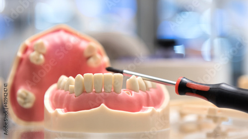 Zahnersatz, Modell, Zahnmedizin