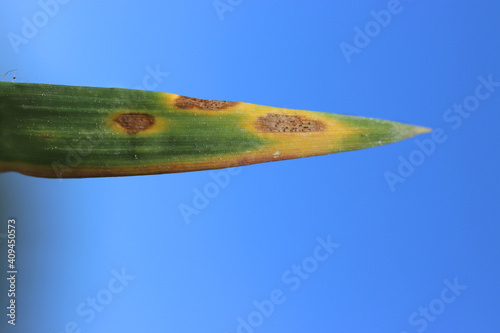 Leaf spot of wheat, speckled leaf blotch of wheat, septoria leaf blotch, cereal diseases
