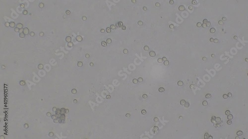 Microscopy of yeast cells (Saccharomyces cerevisiae). Monochrome background of granular cells moving.