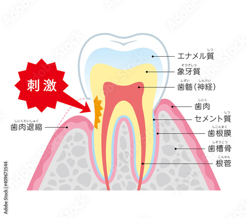 Tooth cross section_20