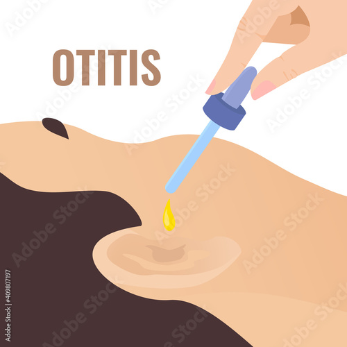 Doctor putting in the drops to the patient ear. Otitis disease treatment. Remedy for hearing problems. Earache as a symptom of coronavirus. Medical vector illustration in closeup.