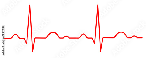 Electrocardiogram - 2