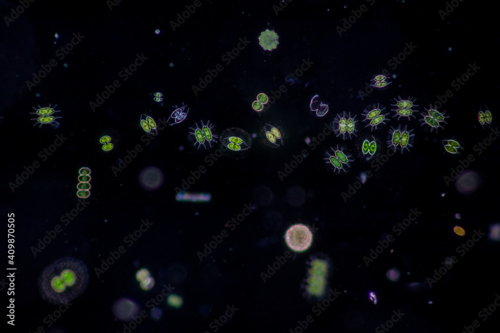 Foto de Protozoa and Green Algae in waste water under the microscope ...