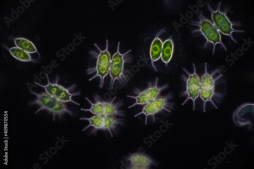 Protozoa and Green Algae in waste water under the microscope.
 photo