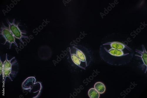 Protozoa and Green Algae in waste water under the microscope.
 photo