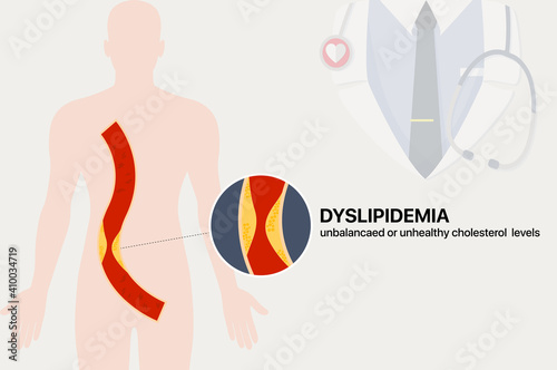 Dyslipidemia, unbalanced and unhealthy cholesterol levels photo