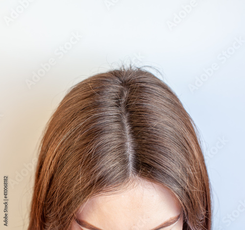 A woman's head with a parting of gray hair.