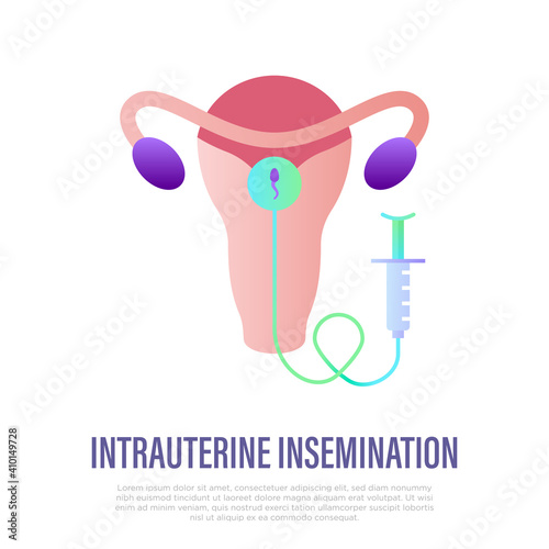 Intrauterine insemination thin line icon. Gynecology. EGG. Uterus and uterine device. Vector illustration.