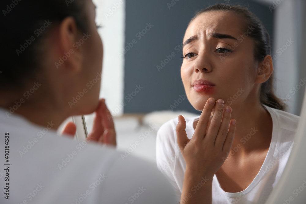 Fototapeta premium Young woman with herpes on lip looking in mirror at home