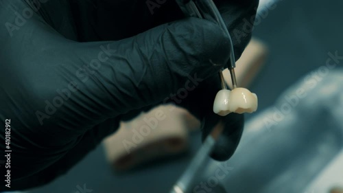 Denture, artificial tooth, denture, hands working on the denture, artificial teeth. Slow motion, close-up.
