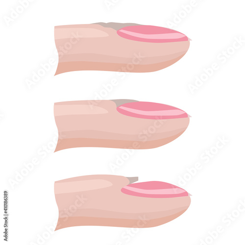 The structure of the nail, types of nail cuticle. Hand nail care. Vector illustration photo