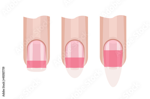 Stress zone of the fingernail. Nail length. Illustration for the manicure guide. Hand nail care .Vector illustration photo