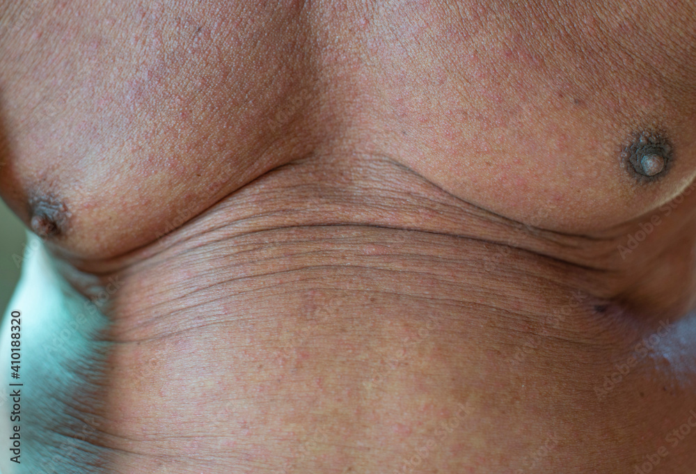 Naklejka premium The shape of the skin, the old man