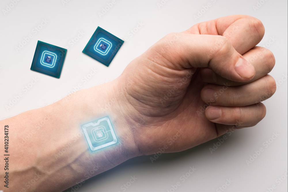 Hand with RFID Chip Implant Stock Photo Adobe Stock