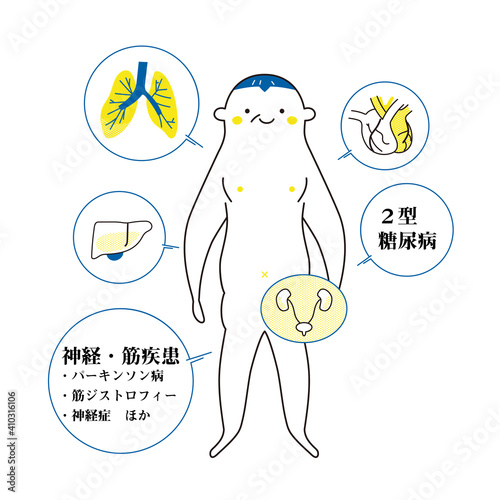 シニア男性をモデルにした基礎疾患の説明図　イラスト
