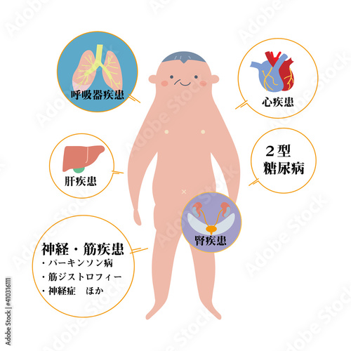 シニア男性をモデルにした基礎疾患の説明図　イラスト
