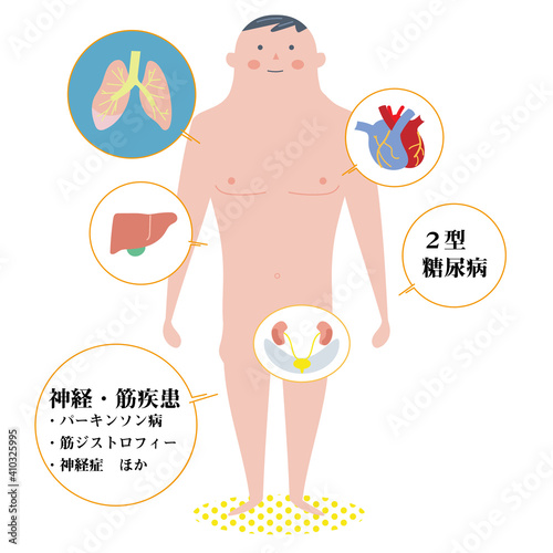 働ぎ盛りの基礎疾患説明図　イラスト
