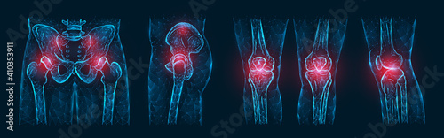Polygonal vector illustration of pain or inflammation of the bones in the pelvis, hip joint, and knee joints isolated on a dark blue background. Orthopedic diseases medical template. photo