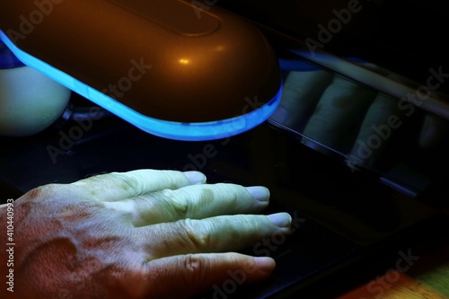 Phototherapy for skin diseases. Treatment of skin diseases such as Vitiligo, Psoriasis, and Eczema with narrow-band ultraviolet B in low ambient light.
