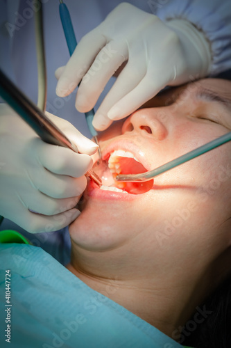 Woman is undergoing dental treatment and specialist is doing check up and curing teeth patient.
