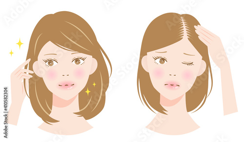 薄毛　女性　ビフォアアフター