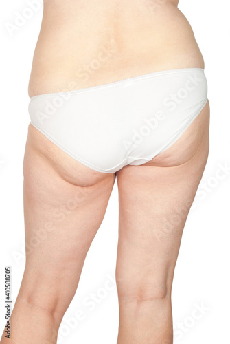 The body of a fat woman