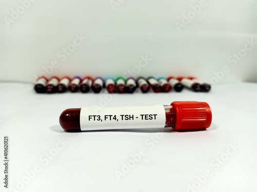 Test Tube with blood sample for Hormonal examination of the thyroid gland in the laboratory. FT3, FT4, TSH. Diagnosis of hyperthyroidism or hypothyroidism of a patient. A medical testing concept. photo
