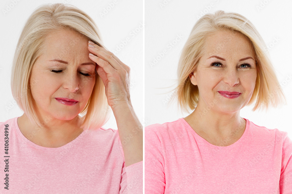Before and after middle aged woman with headache. Beforeafter
