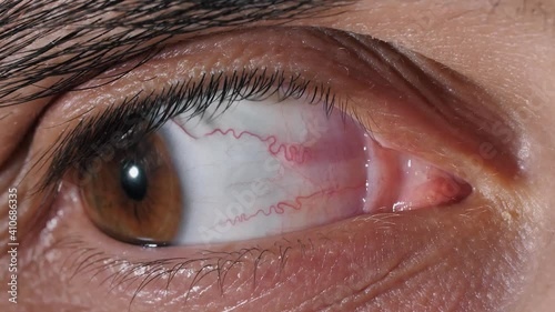 Eye looks to the right and to the left