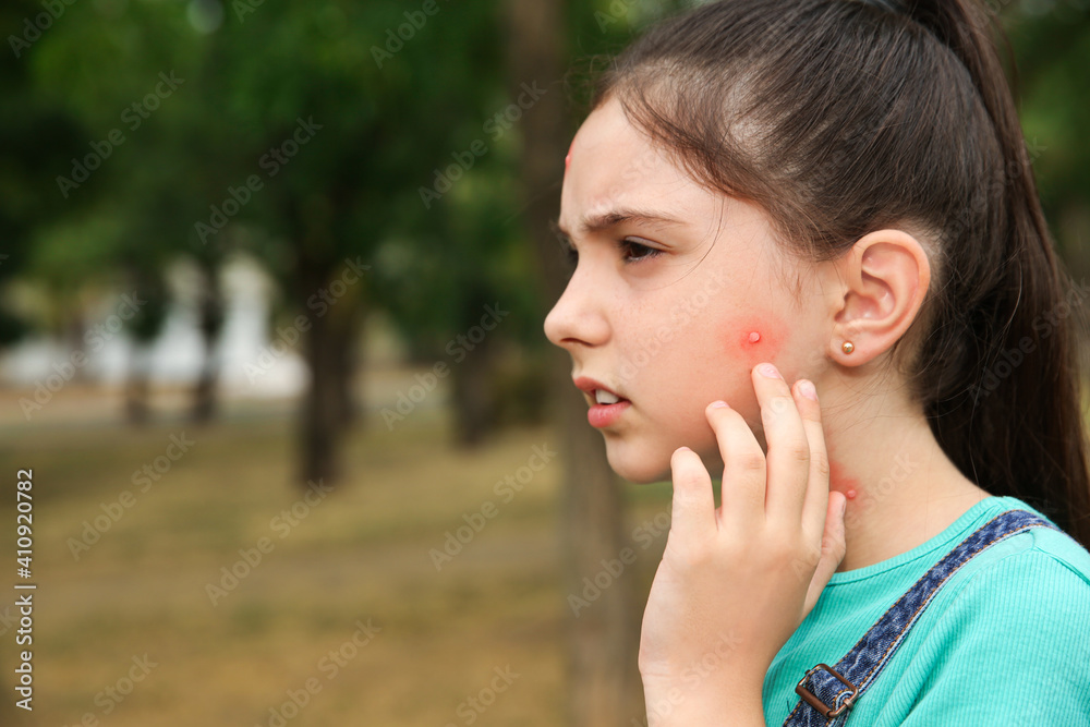 Girl touching cheek with insect bite in park. Space for text Girl touching cheek with insect bite in park. Space for text