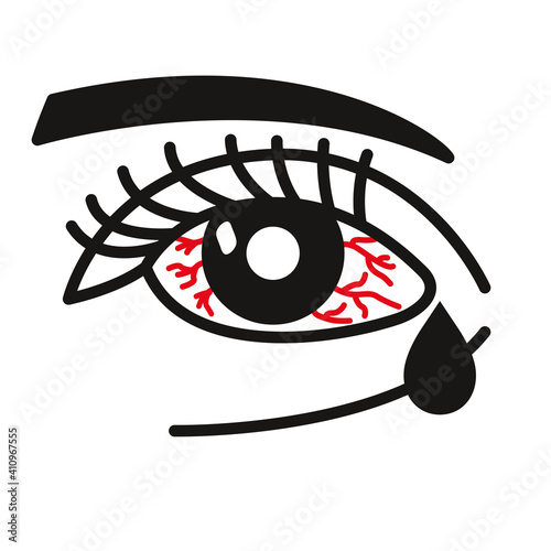 Inflammated eye Conjunctivitis or pink eye. Linear vector illustration photo
