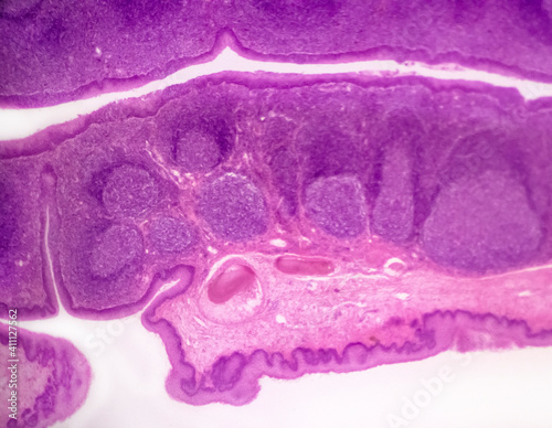 Palatine tonsil cross-section of a domestic cat (Felis catus Linnaeus, 1758) - permanent microscope slide (stained by haematoxylin-eosin)