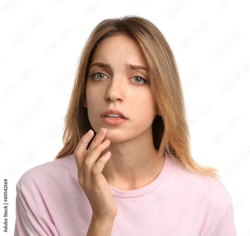 Woman with herpes applying cream onto lip against white background Woman with herpes applying cream onto lip against white background