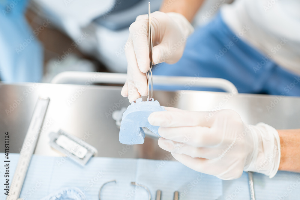 Orthodontist working with jaw model applying brace system, modeling orthodontic treatment for a patient. Dentist working at the laboratory. High quality photo Orthodontist working with jaw model applying brace system, modeling orthodontic treatment for a patient. Dentist working at the laboratory. High quality photo