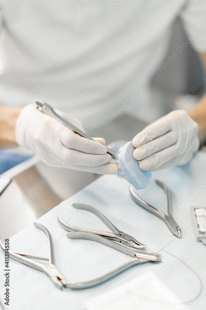 Dental technician working with a model of teeth trying on a brace system for orthodontic treatment at the laboratory. Close-up. High quality photo Dental technician working with a model of teeth trying on a brace system for orthodontic treatment at the laboratory. Close-up. High quality photo