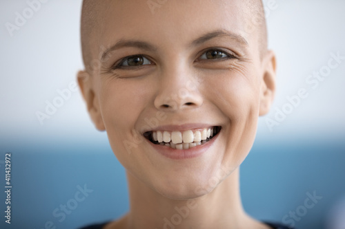 Crop close up portrait of smiling young Caucasian female cancer patient feel optimistic overjoyed with recovery remission. Happy millennial woman struggle fight with oncology look at camera.