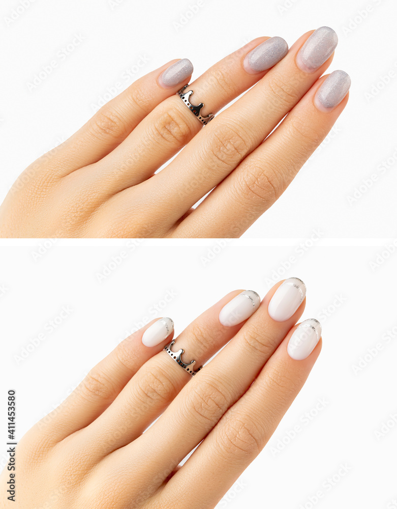 Womans hands before and after manicure correction procedure Womans hands before and after manicure correction procedure