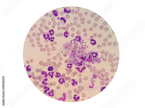 Foto Platelets, also called thrombocytes clumps in a blood smear of dog
