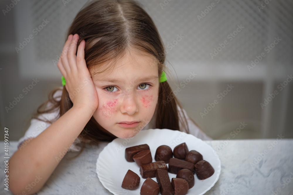 A little girl with an allergic rash on her cheeks sits at a table next