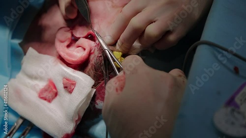 Plastic surgeon performs facelift surgery with a scalpel, tweezers and clamps, close up. High quality FullHD footage