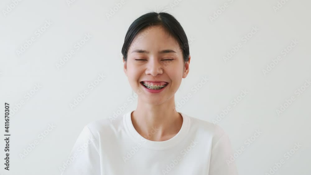 Asian women slowly smiled and laughed happily. A girl wearing braces. Asian women slowly smiled and laughed happily. A girl wearing braces.