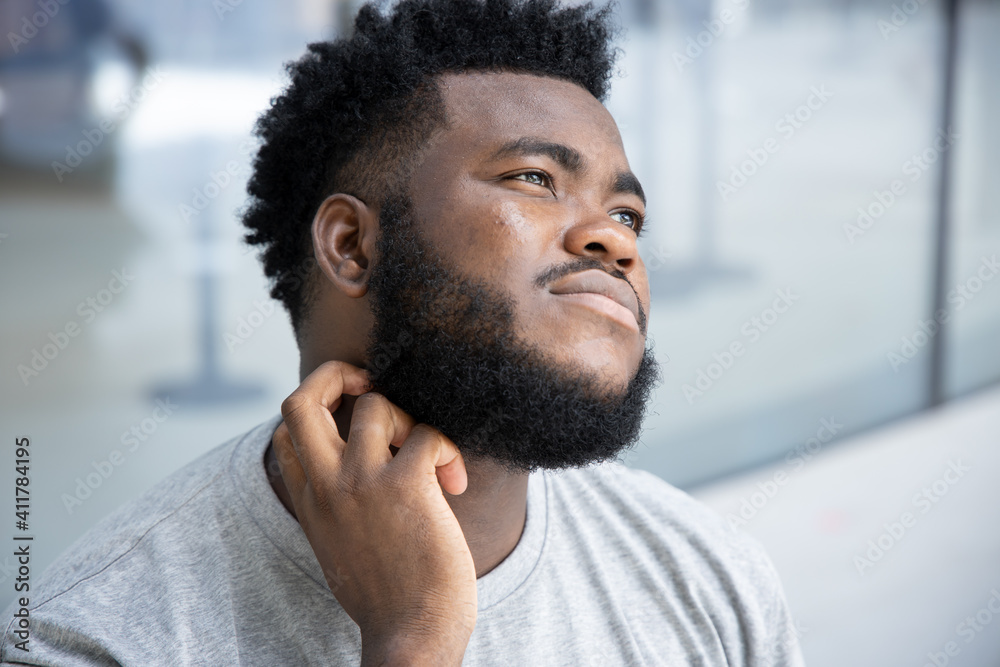 Man scratching suffering from itching neck skin; sick African man scratching his skin with allergy, rash, ringworm, tinea problem; skin care, dermatology concept; adult black African man model Man scratching suffering from itching neck skin; sick African man scratching his skin with allergy, rash, ringworm, tinea problem; skin care, dermatology concept; adult black African man model