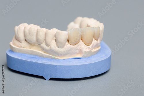 close up of artificial dentition in a dental laboratory ready for use 