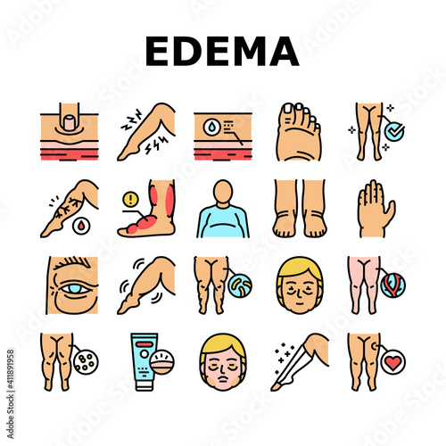 Edema Disease Symptom Collection Icons Set Vector. Venous And Fatty, Lymphatic And Hypoproteinemic, Allergic And Heart Edema Health Problem Concept Linear Pictograms. Contour Color Illustrations