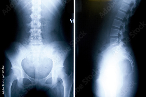 x ray image of knee