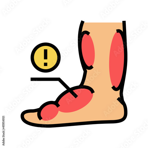 leg edema critical leg health problem color icon vector. leg edema critical leg health problem sign. isolated symbol illustration