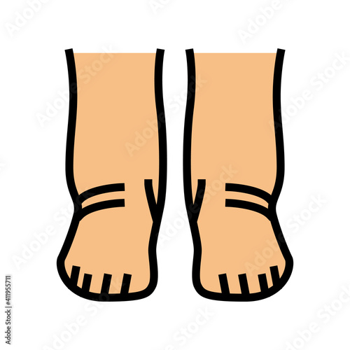 feet edema health disease color icon vector. feet edema health disease sign. isolated symbol illustration