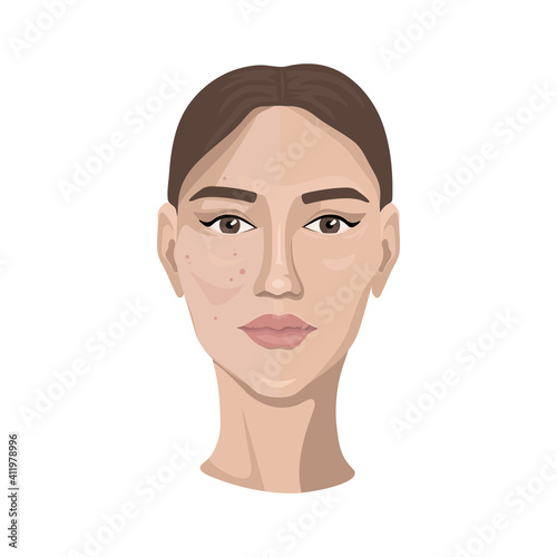 Beauty and freshness of woman face vector illustration. Girl with skin spots, pimples and wrinkles